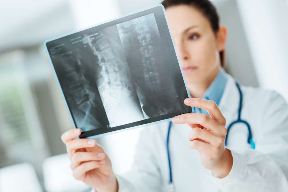 fractured rib car accident settlement